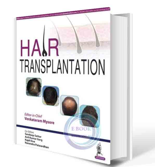 دانلود کتاب Hair Transplantation 1st 2016(ORIGINAL PDF)